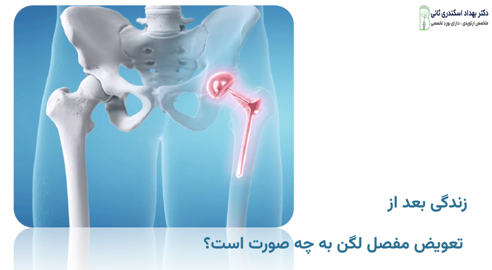 زندگی بعد از تعویض مفصل لگن به چه صورت است؟