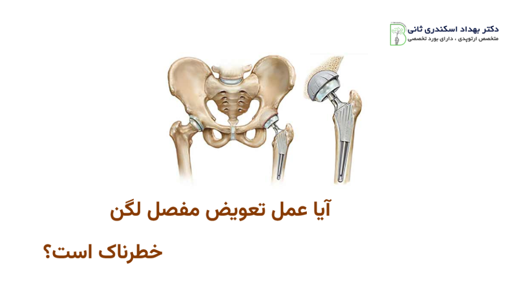 آیا عمل تعویض مفصل لگن خطرناک است؟