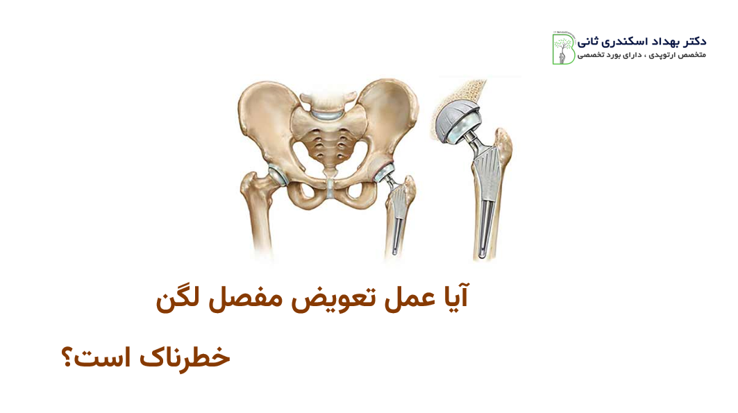 آیا عمل تعویض مفصل لگن خطرناک است؟